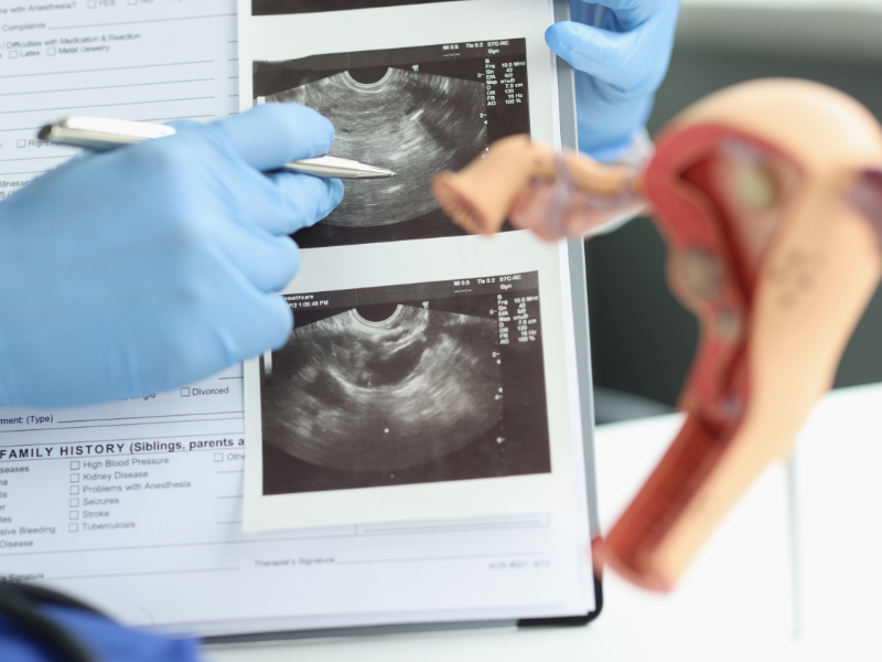 histerosonografia-dany